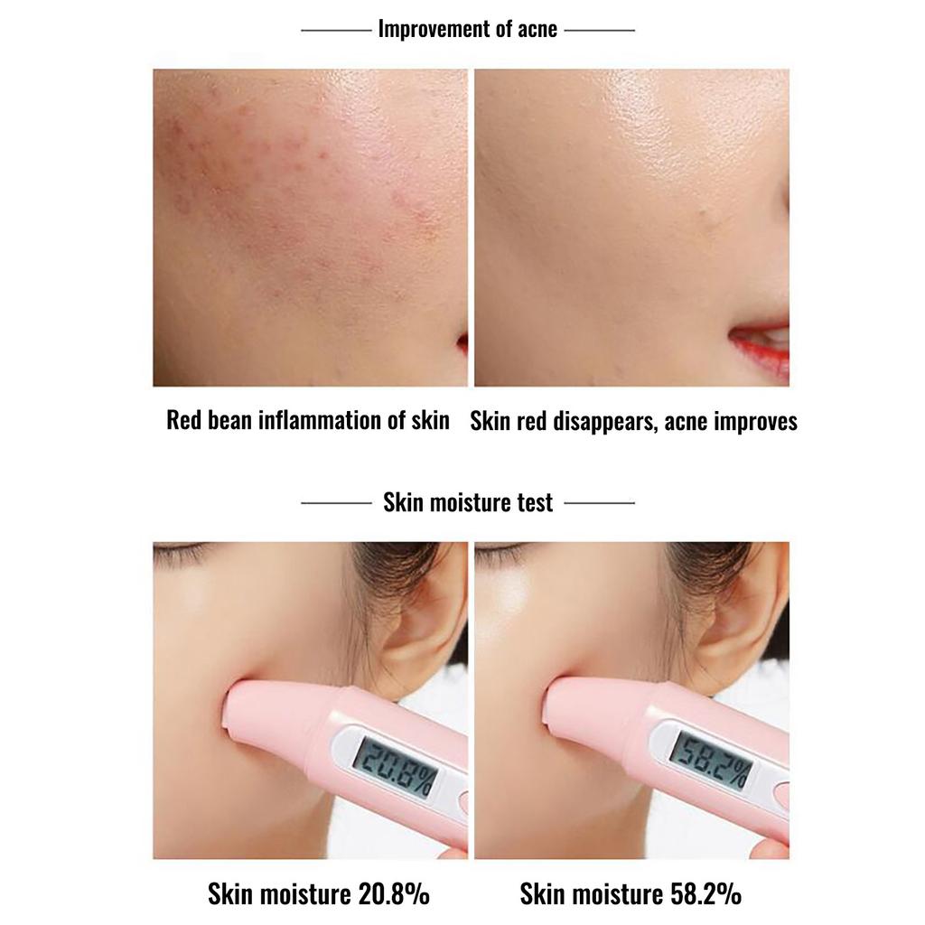 Grüntee-Schlammmaske, reinigende Maske, feuchtigkeitsspendend und hydratisierend