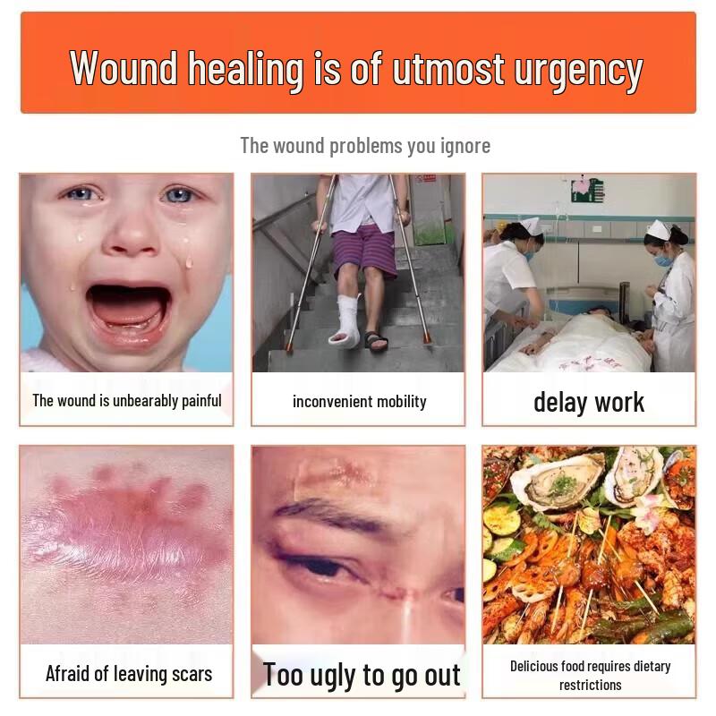 Nuobiyan Wound Healing Spray