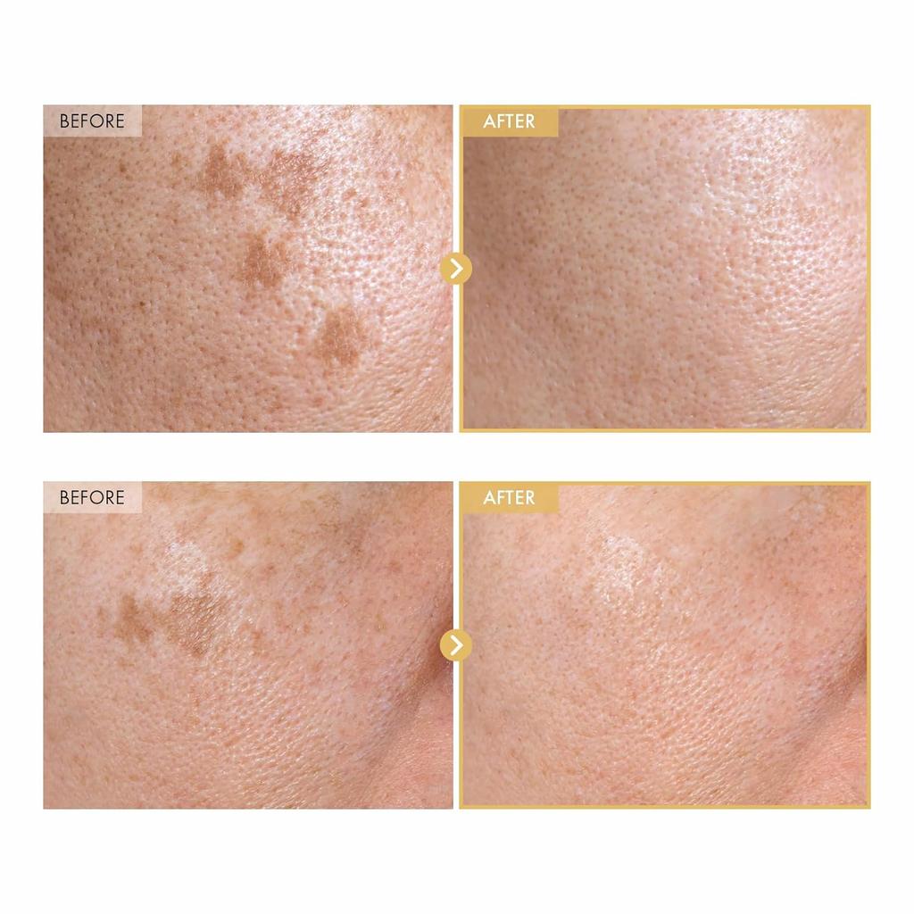 TOSOWOONG Black Snail Ginseng Serum 30ml