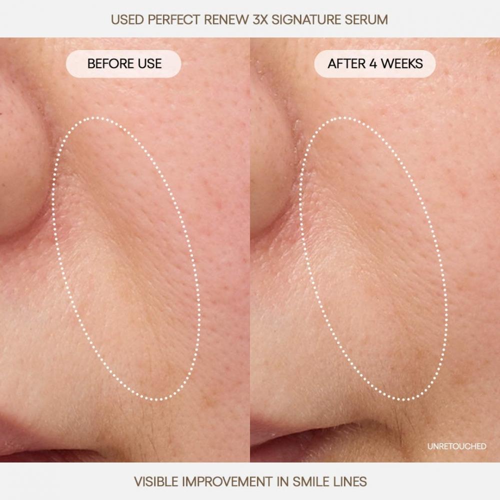 Laneige Perfect Renew 3x Signature Serum Anti Aging  Firming   Lifting 0.6 Oz 20 Ml