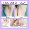 CyperGlow - Cyperus Rotundus Oil, Cyperus Oil Hair Removal, Cyperus Oil Natural New Arrival
