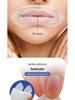 BreathSeal: Soft, Skin-Friendly Anti-Mouth Opening Patch for Adults & Children