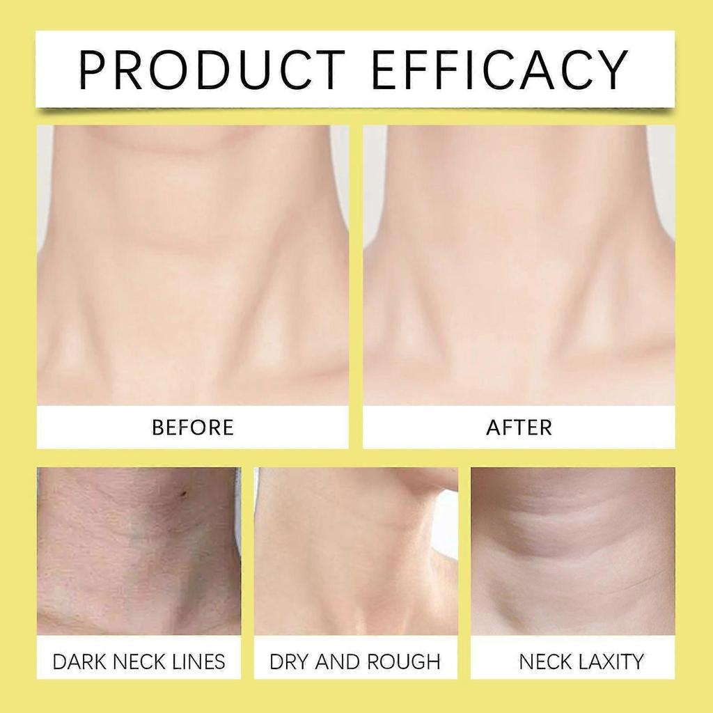 Neck Cream, Anti-Aging Neck Firming Cream, Hydrating & Tightening Treatment, Reduces Wrinkles, Fine Lines, Lifts & Smooths Skin for Youthful Look