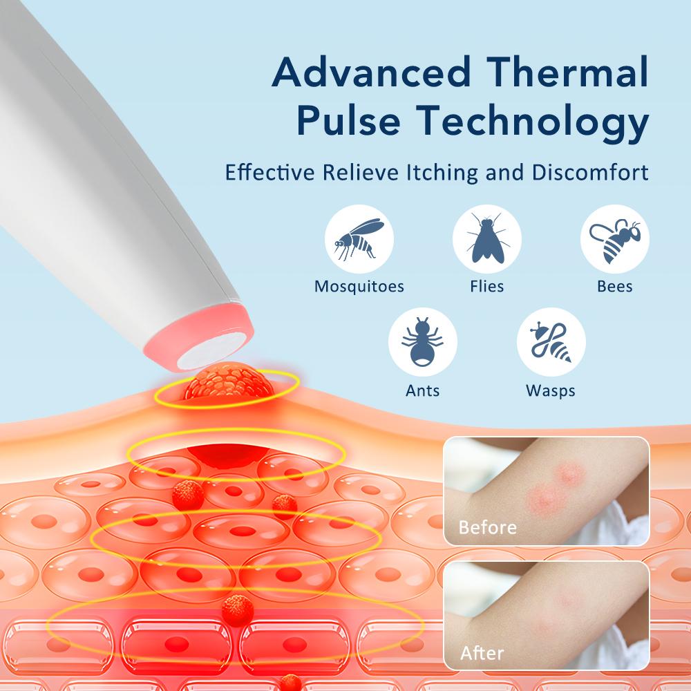 Rechargeable Portable Mosquito Insect Bite Relieve Itching Pen Chemical-Free Anti-Itch Natural Bug Bite Itch Pen for Adult Child