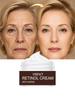 Retinol Cream Anti-Wrinkle Cream Anti Aging Lifting Fade Fine Line Face Cream Moisturizing Nourish Skin Care