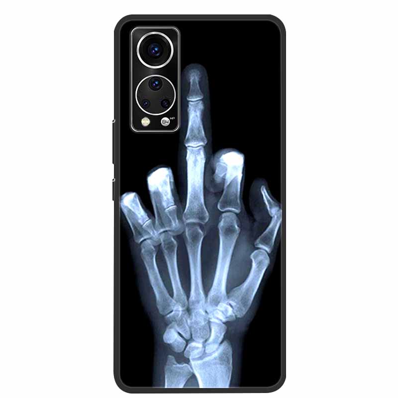 Für ZTE Axon 30 Handyhülle Cover Cooler Wolf Löwe Tiger Schwarzes Silikon Weiche Hülle Für ZTE Axon 30 Rückabdeckung Hülle Axon30 5G Hülle