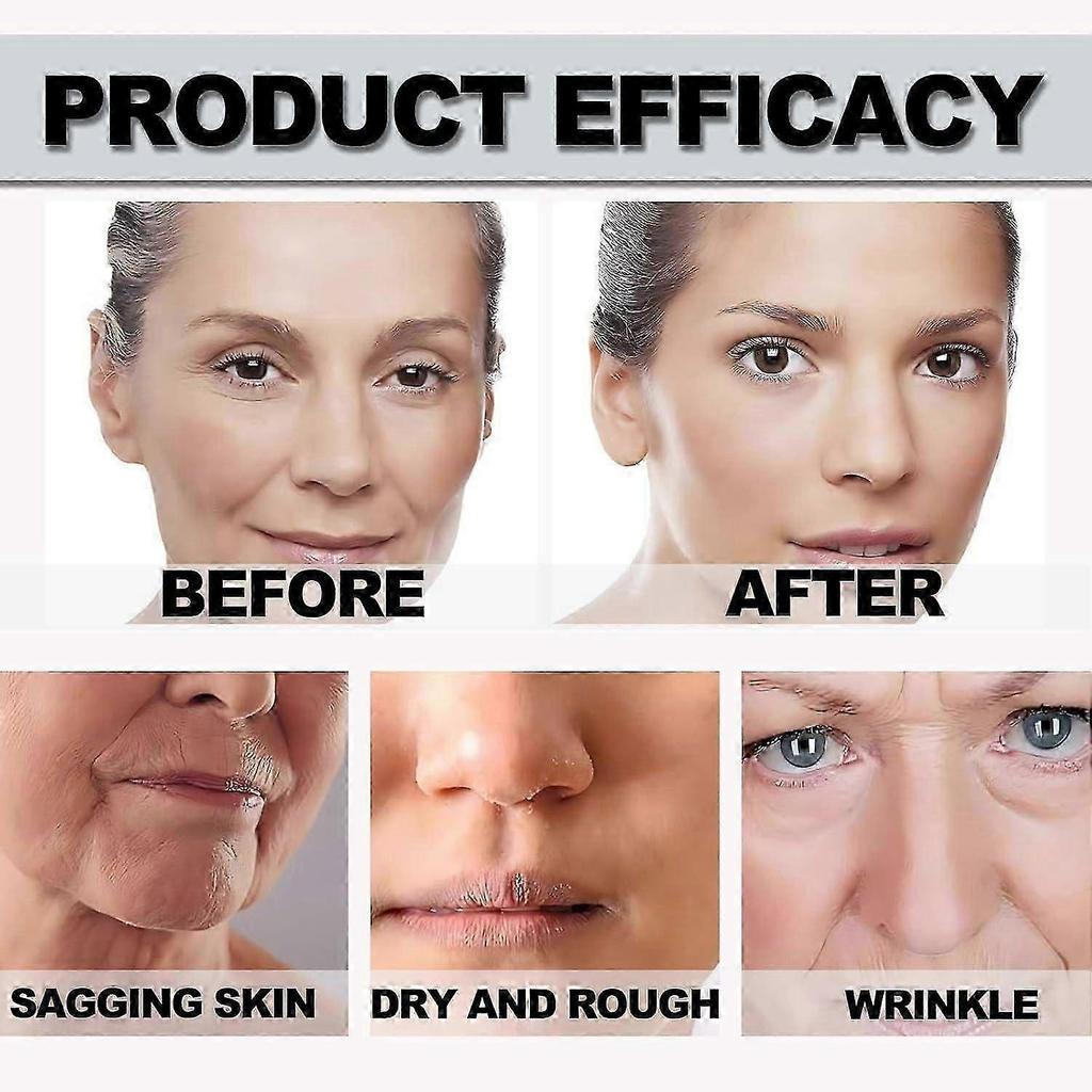 Bee Venom Cream - Anti-Aging Bee Venom Cream- Bee Venom Wrinkle Removal & Firming Cream, Moisturizing, Lifting & Recovery - Face Moisturizer for All S