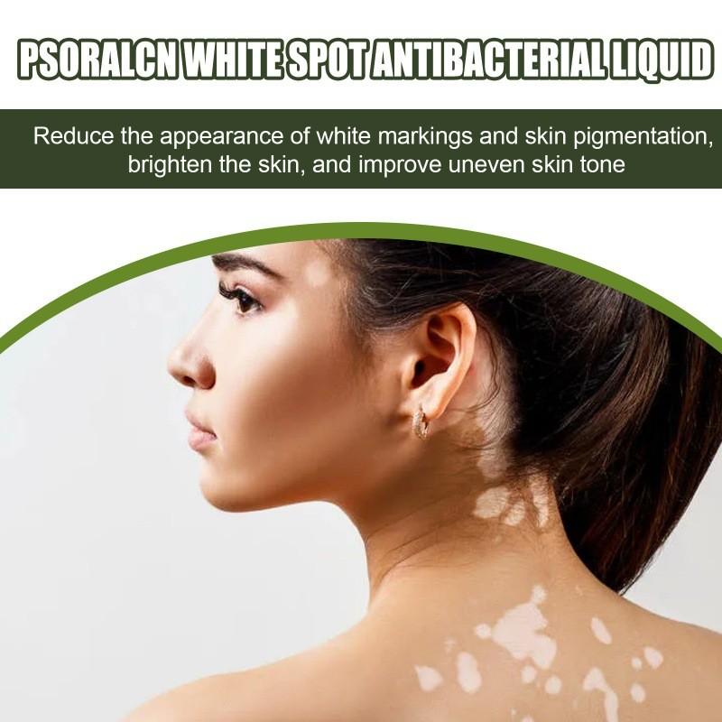 Eelhoe White Spot Repair Serum For Skin Brightening Moisturizing And Nourishing Care