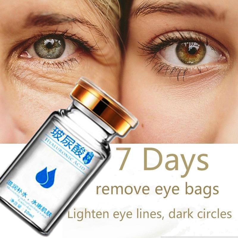 dark circles hyaluronic acid