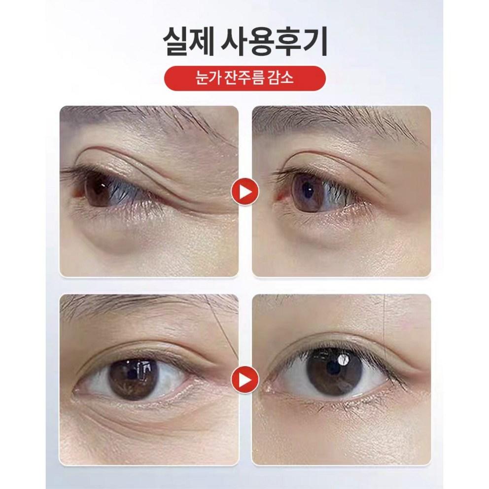 [Kollagen] Anti-Aging Augencreme, Reduziert Augenringe & Falten, 20g