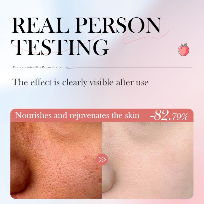 Peach Lactic Acid Bacteria Serum 30ml SADOER Nourishing, Moisturizing and Rejuvenating Serum Batch