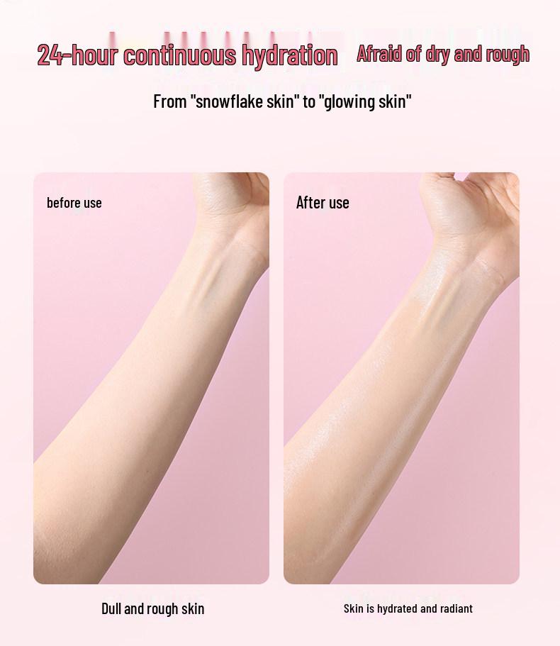 Johnson's Baby Feuchtigkeitsöl für Neugeborenenmassage und Hautpflege, Ideal für Kopfgneis und Mitesser.