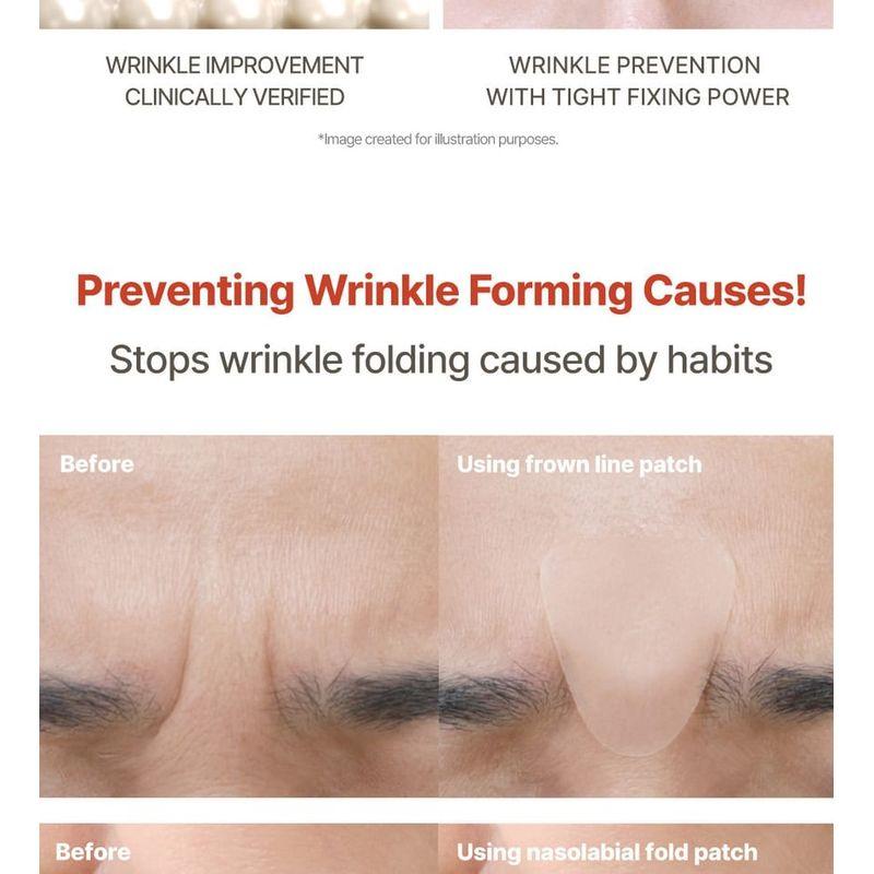 MARSHIQUE - Wrinkle Repair Forehead Wrinkle Patch