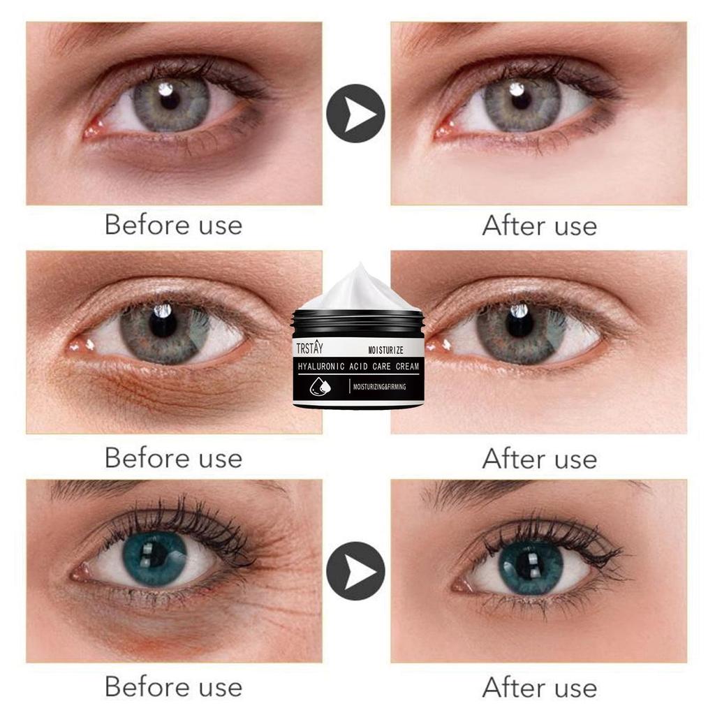 The Moisturizing Eye Cream Gently Does Not Irritate and Smooths Wrinkles, Reduces Fine Lines, Smooths and Refines, and Improves Damaged Skin