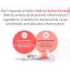 DONG-A PHARM Acnon Cream 13g & Aclean Gel 20g,K-beauty Cosmetics