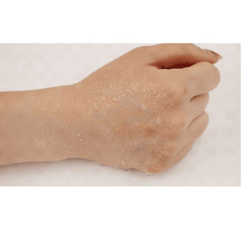 VT - Cica Spot Patch