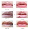 5Pcs Moisturizing Lip Mask Lip Hydrating Repair Remove Fine Lines Lip Masks Lip Care MYY