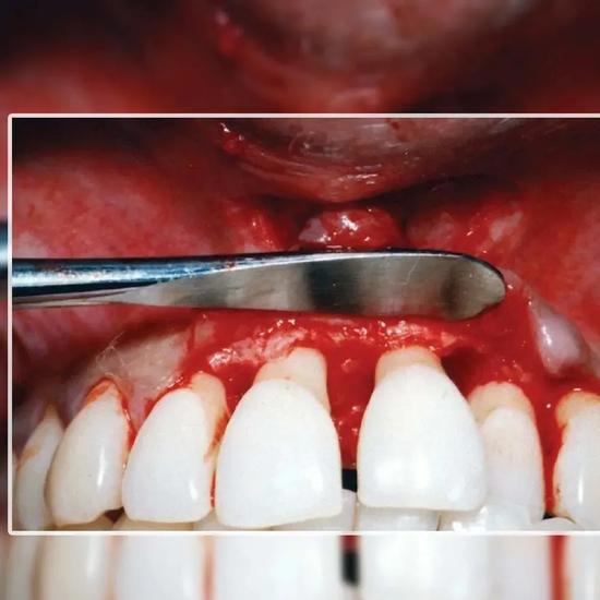 GDC Micro Surgery Instruments (Msiwc6)