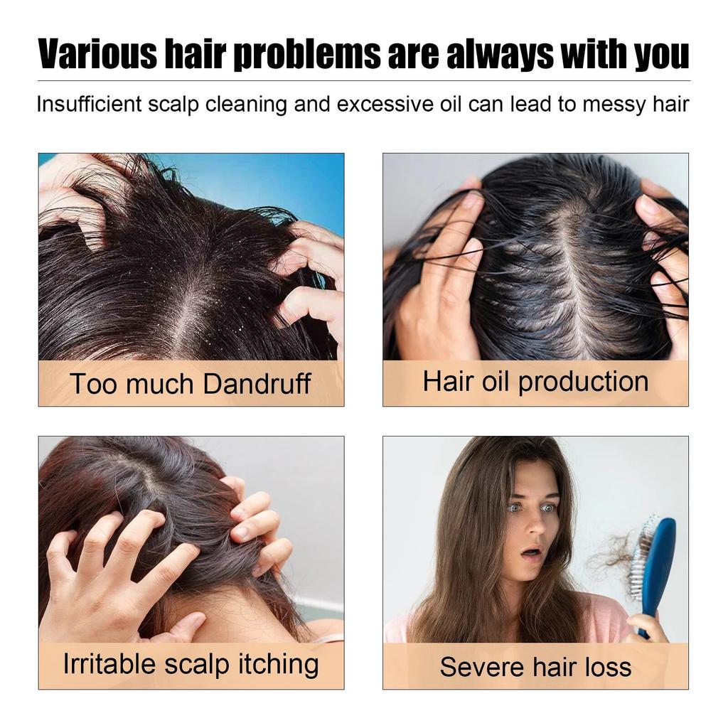 Anti Hair Loss Scrub Smoothing Moisturizing Roots Baldness Treatment Nourish Hair Regeneration Deep Cleansing Scalp Scrub Cream