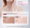 Brightening Spot Cream: Fades Pigmentation, Improves Skin Tone and Texture, Reduces Melasma and Yellowing