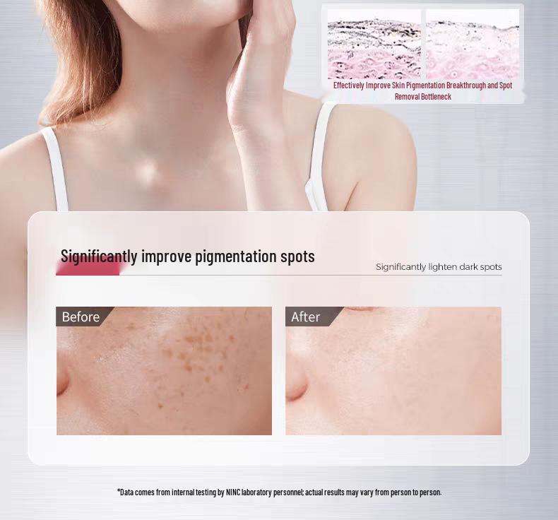 Brightening Spot Cream: Fades Pigmentation, Improves Skin Tone and Texture, Reduces Melasma and Yellowing