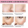 Jaysuing Of Collagen Complex Serum Firming Skin Anti-wrinkle Repair Barrier Skin Care Light Wrinkle
