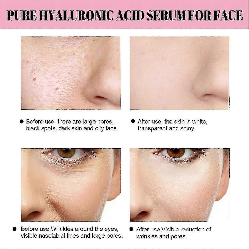 Jaysuing Of Collagen Complex Serum Firming Skin Anti-wrinkle Repair Barrier Skin Care Light Wrinkle