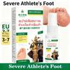 Spray Herbal para Pés de Secagem Rápida - Eliminador de Odor e Controle de Suor Pós-Treino