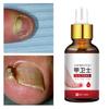Nail Antibacterial Solution Disinfection Herbal Ingredients Synthetic Toenail Fungal Treatment Liquid for Feet Care