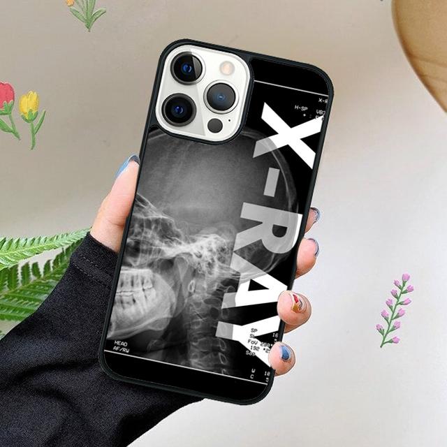Röntgenaufnahme Menschliche Anatomie Handyhülle Für iPhone 17 Air 15 16 16e 11 12 13 14 Pro Max Hülle Für iPhone 17 Air Max Plus coque Fundas