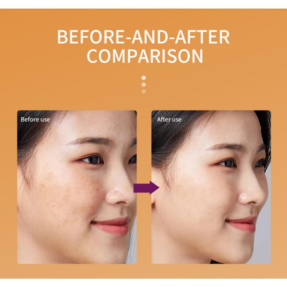 Gurkemeieessens lysner hudtonen og reduserer melasma