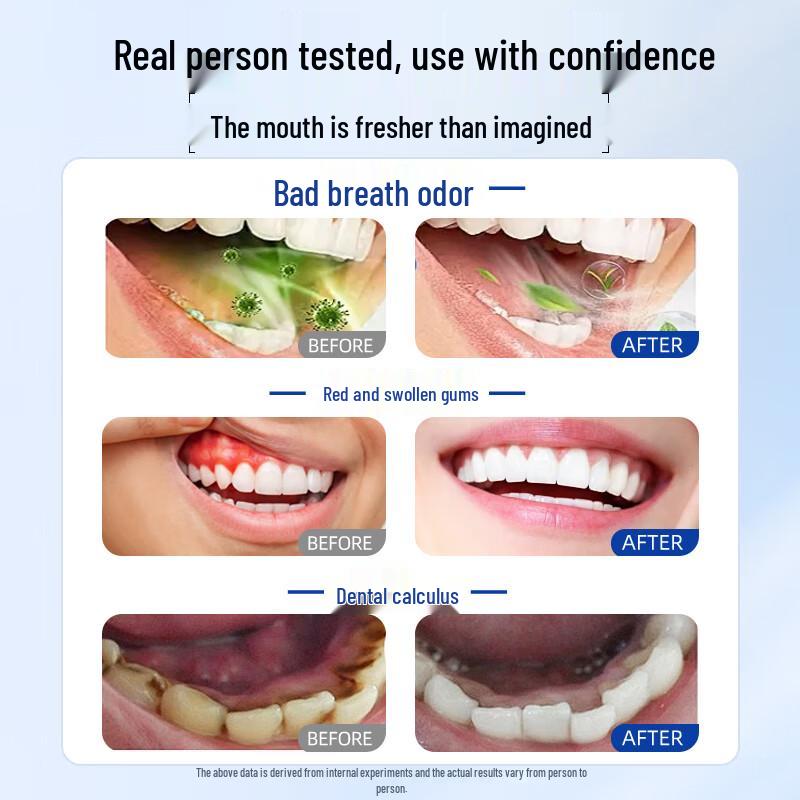Tongrentang Povidone-Iodine Mouthwash