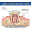 SOUTH MOON Dentifrice Fixation Gingivale Soignant les Dents Apaisant la Douleur Gingivale