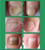 Electric Toenail Grinder & Polisher for Thick Nails