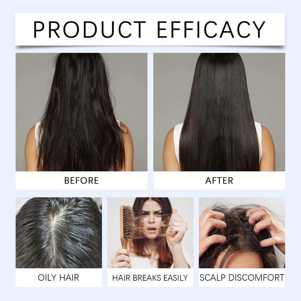 Haarwuchsserum Roll-On 30ml Für Dünner werdendes Haar & Alle Haartypen Nährende Kopfhaut Fördert Haarwachstum Serum Öl Roll-on Serum Öl, 30ml