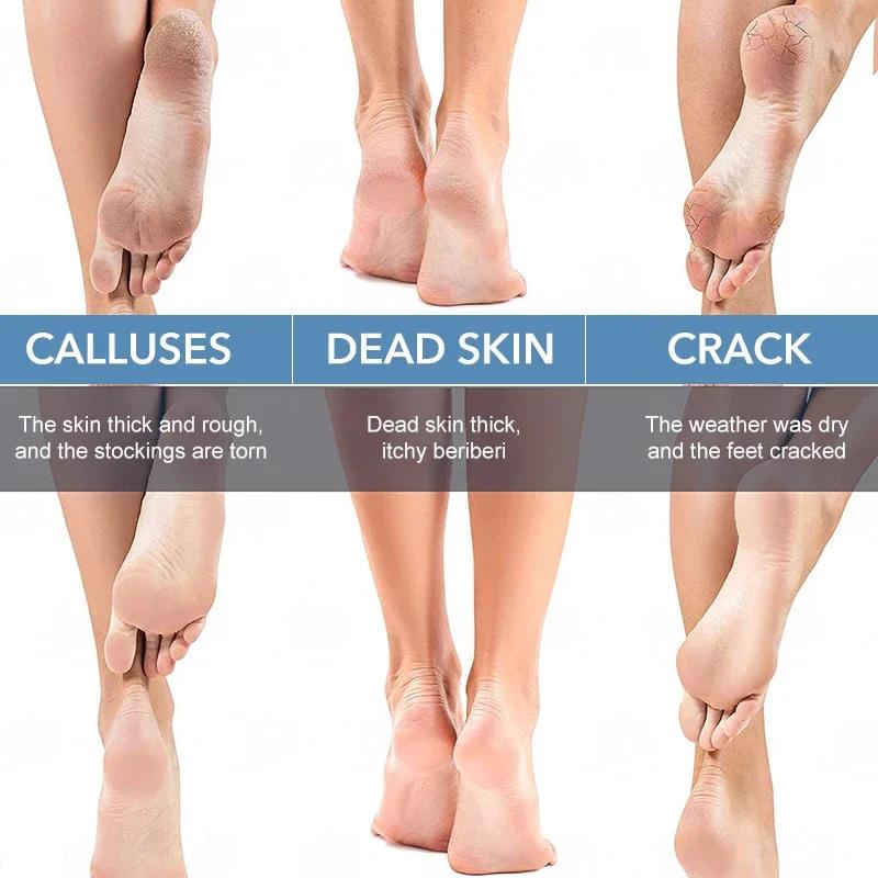 Râpe à pieds en verre nano, râpe pour éliminer les callosités et les peaux mortes, gommage des pieds, exfoliation des talons, outils de pédicure, soins des pieds