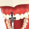 Dental Kieferorthopädische Ästhetische Zähne Krone Proportional Gauge Zahnarzt Implantat Mess Lineal Messschieber Edelstahl