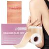 hot sale 1 Roll Silicone Scar Sheet Painless Scar Repair Tape Roll Effective Scar Waterproof Breathable Ear Beauty Sticker