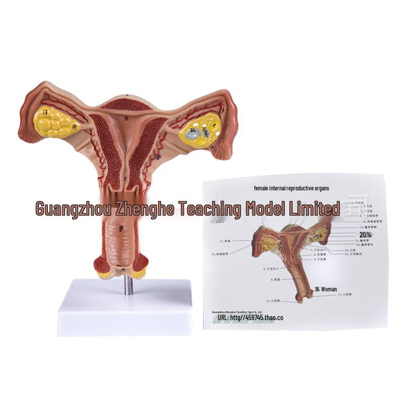 Female Pathology Uterus Model for Obstetrics & Gynecology Education