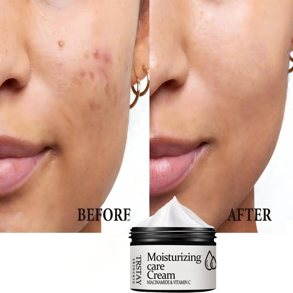 Blemish Serum Cream To Reduce Fine Lines, Smooth Wrinkles and Improve Damaged Skin