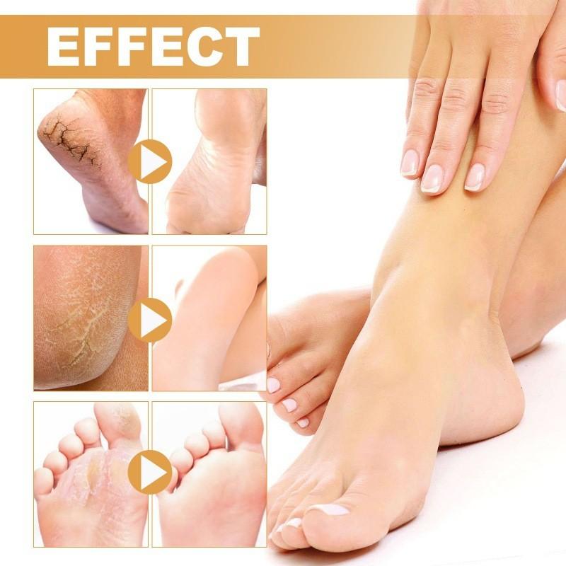 Nourishing Ouhoe Foot Spray For Softening Rough Skin And Removing Dead Skin Cells