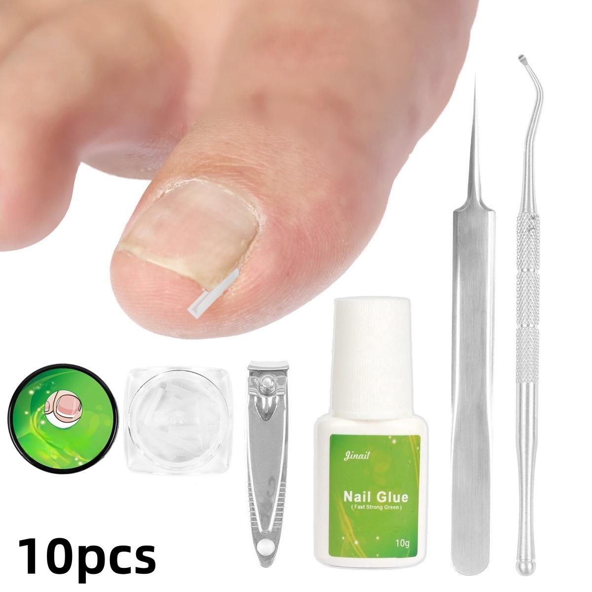 

Інструмент для корекції нігтя великого пальця ноги Лікування нігтів пальців ніг Еластична наліпка-пластир Випрямляючий затискач Брекет Інструмент для педикюру 10-pcs