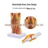 Removable Human Knee Joint Anatomy Model with Skin, Bones, Ligaments, and Meniscus for Medical Teaching
