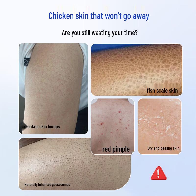 SEVENGREEN Fruchtsäure VE Urea Feuchtigkeitsspendende Körpercreme