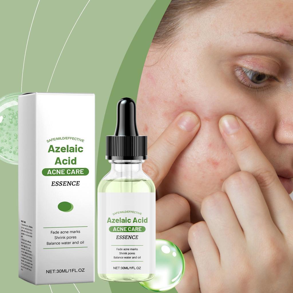 Azelaic Facial Serum Moisturizes And Improves The Skin For Blackheads And Acne 30ml