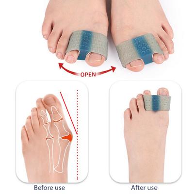 2 Stück Zehenspreizer, orthopädischer Bunion Valgus Hammerzehen-Korrektor, natürliche Neuausrichtung, Frauen und Männer, Fußausrichtung, Zehenabstandshalter, Hammerzehen-Glätteisen