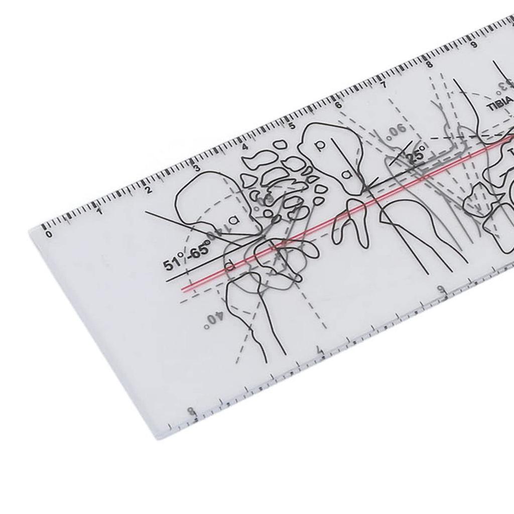 Orthopedics Ruler, Multiple Function Midlayer Printing Lasting Spinal Goniometer For Rehabilitation Assessment