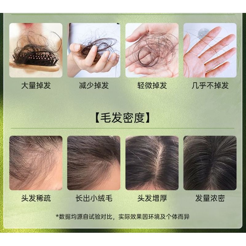 ZOOLY - No. 9 Anti Hair Loss Scalp Care Essence