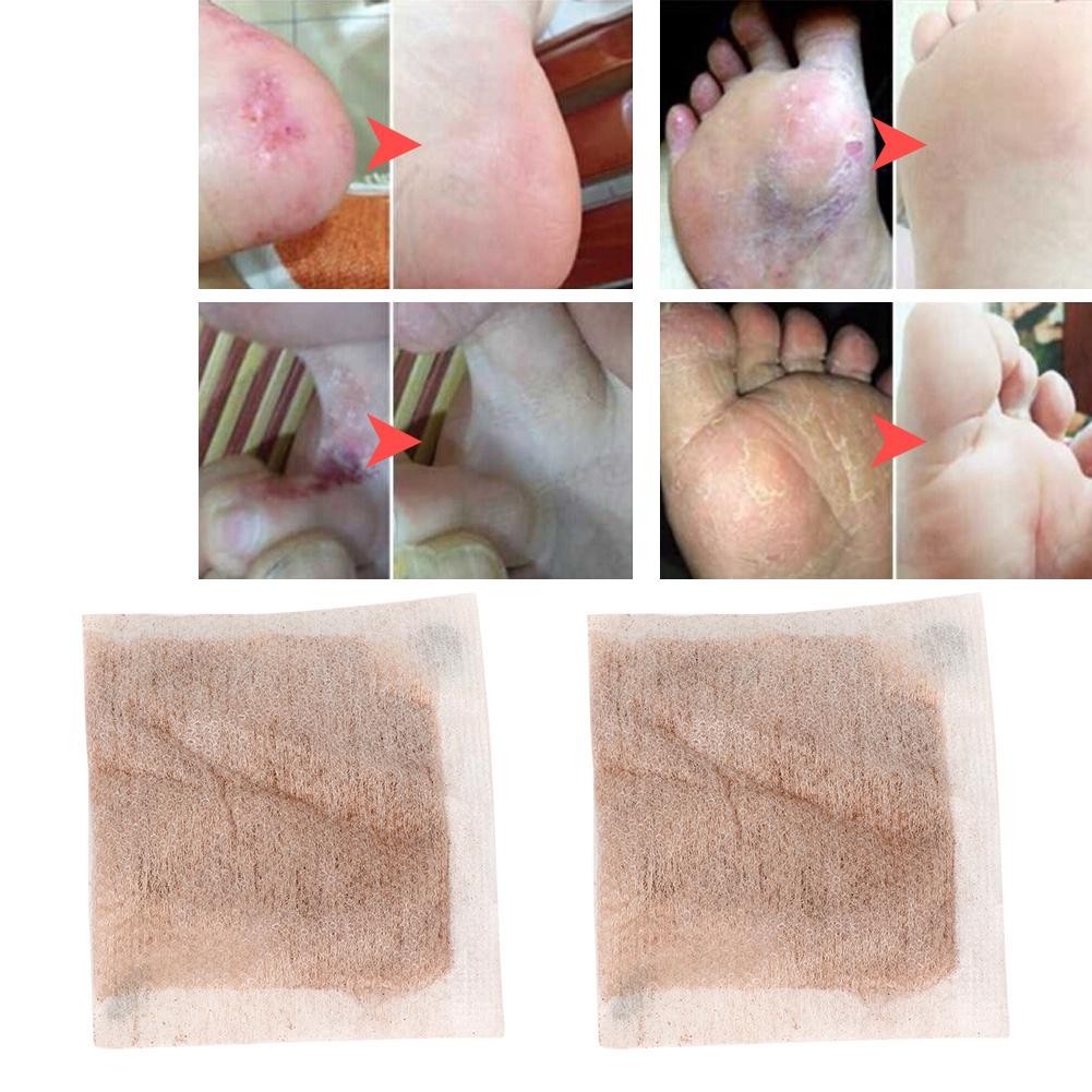 Natural Plants Foot Bath Powder Chinese Herbal Foot Skin Health Care (Genseng)