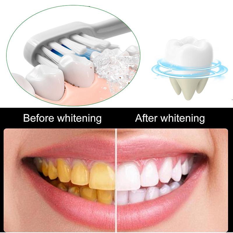 Blanchir les dents réparation dentifrice carie dentaire enlever la Plaque soulager la parodontite mal de dents élimination rafraîchit l'haleine soins des dents
